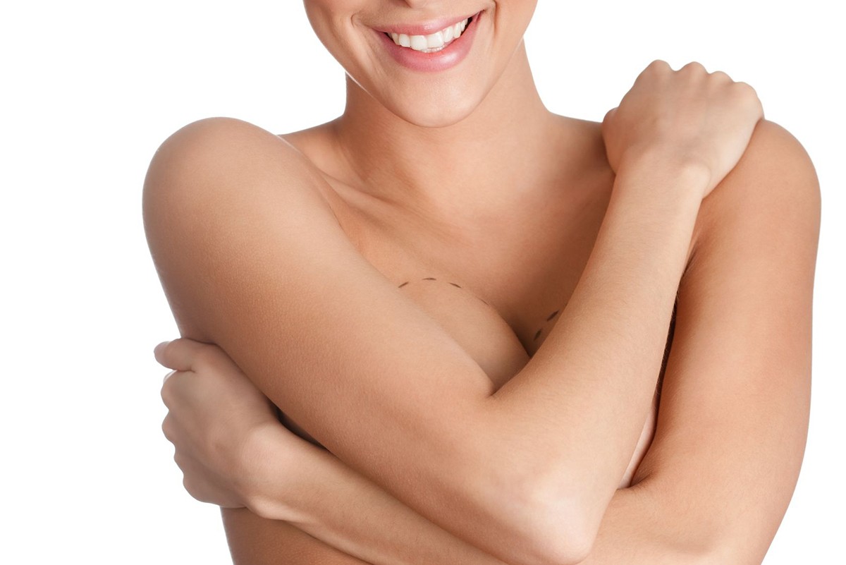 10 Breast Augmentation Myths and Facts People Still Believe